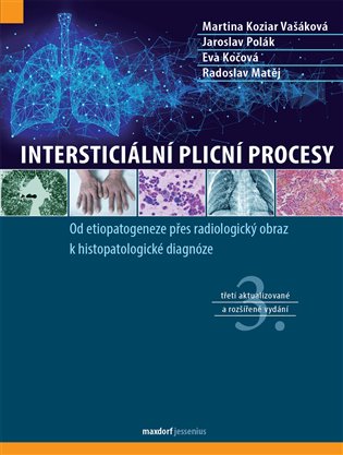 Intersticiální plicní procesy - kol.