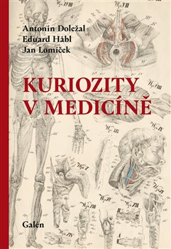 Kuriozity v medicíně koupíte na Kosmas.cz