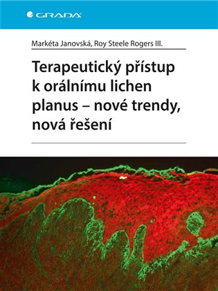 Terapeutický přístup k orálnímu lichen planus: Nové trendy, nová řešení - Markéta Janovská, Roy Steele Rogers III.