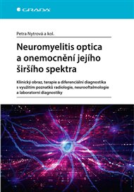 Neuromyelitis optica a poruchy jejího širšího spektra: Klinický obraz, terapie a diferenciální diagnostika s využitím poznatků radiologie, neurooftalmologie a laboratorní diagnostiky - Petra Nytrová,  kolektiv