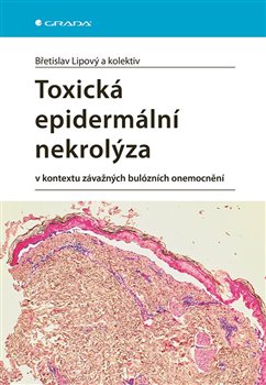 Toxická epidermální nekrolýza v kontextu závažných bulózních onemocnění koupíte na Kosmas.cz