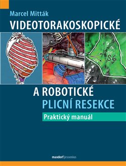 Videotorakoskopické a robotické plicní resekce koupíte na Kosmas.cz