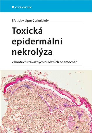 Toxická epidermální nekrolýza: V kontextu závažných bulózních onemocnění - Břetislav Lipový,  kol.