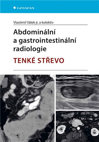 Abdominální a gastrointestinální radiologie - Játra - Vlastimil Válek,  kolektiv