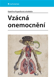 Vzácná onemocnění - Kateřina Kopečková,  kolektiv