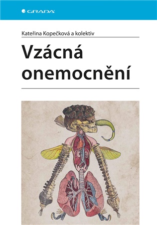 Vzácná onemocnění - Kateřina Kopečková,  kolektiv