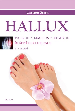 Hallux: Řešení bez operace - Carsten Stark