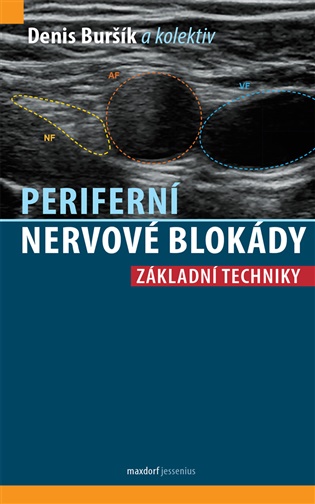 Periferní nervové blokády - Denis Buršík,  kol.