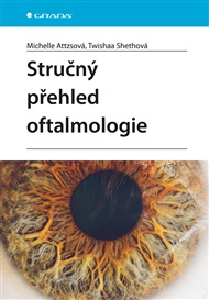 Stručný přehled oftalmologie - Michelle Attzsová, Twishaa Shethová
