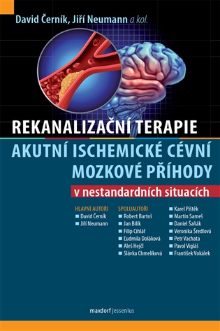 Rekanalizační terapie akutní ischemické cévní mozkové příhody v nestandardních situacích -  kol.