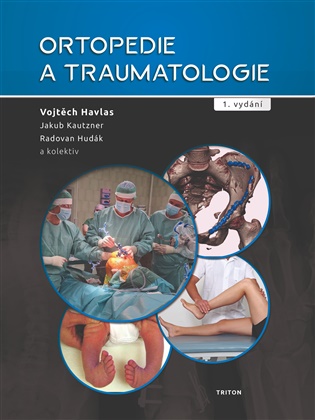 Ortopedie a traumatologie - Vojtěch Havlas, Radovan Hudák, Jakub Kautzner