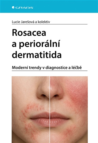Rosacea a periorální dermatitida: Moderní trendy v diagnostice a léčbě - Lucie Jarešová, pedagogů: kolektiv, pedagogů: kolektiv,  kolektiv
