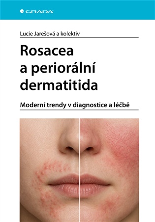 Rosacea a periorální dermatitida: Moderní trendy v diagnostice a léčbě - Lucie Jarešová, pedagogů: kolektiv, pedagogů: kolektiv,  kolektiv