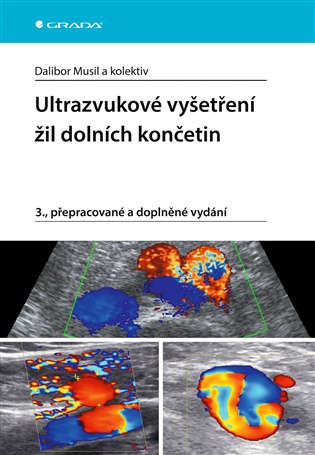 Ultrazvukové vyšetření žil dolních končetin: 3., přepracované a doplněné vydání - pedagogů: kolektiv, Dalibor Musil